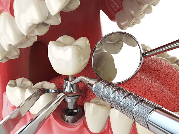 Best Knocked-Out Tooth Emergency  in Dalton, PA
